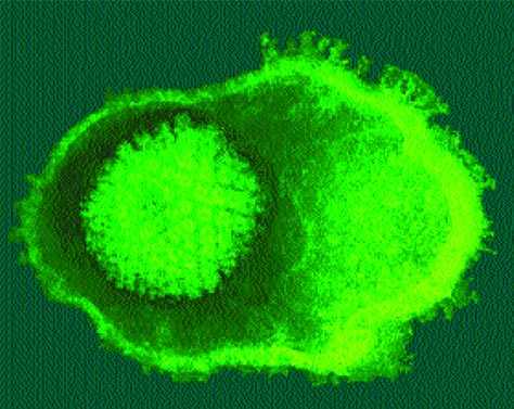 Mononucleosi_fig1